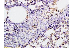 Immunohistochemistry (Paraffin-embedded Sections) (IHC (p)) image for anti-Solute Carrier Family 5 (Sodium/glucose Cotransporter), Member 1 (SLC5A1) (AA 401-500) antibody (ABIN738066)