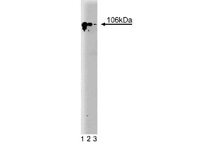 Western blot analysis of SATB1 on a Jurkat cell lysate (Human T-cell leukemia, ATCC TIB-152). (SATB1 抗体  (AA 550-667))