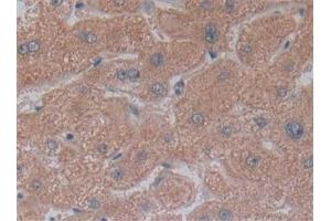 Detection of NT5C3 in Human Liver Tissue using Polyclonal Antibody to 5'-Nucleotidase, Cytosolic III (NT5C3) (NT5C3 抗体  (AA 52-336))