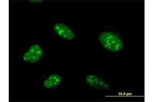 Immunofluorescence of purified MaxPab antibody to ZNF593 on HeLa cell. (ZNF593 抗体  (AA 1-116))