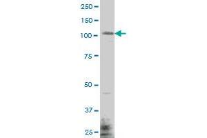 EHMT1 monoclonal antibody (M04), clone 1H2 Western Blot analysis of EHMT1 expression in MES-SA/Dx5 . (EHMT1 抗体  (AA 1-100))