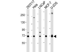 All lanes : Anti-GC Antibody (Center) at 1:2000 dilution Lane 1: 293T/17 whole cell lysate Lane 2: Hela whole cell lysate Lane 3: LNCaP whole cell lysate Lane 4: MCF-7 whole cell lysate Lane 5: U-2OS whole cell lysate Lysates/proteins at 20 μg per lane. (Gc (AA 337-365), (Center) 抗体)