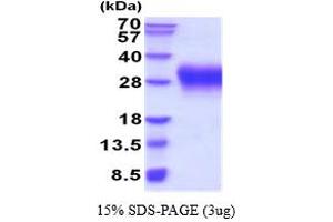SDS-PAGE (SDS) image for V-type immunoglobulin domain-containing suppressor of T-cell activation (VISTA) (AA 33-194) protein (His tag) (ABIN5854456)