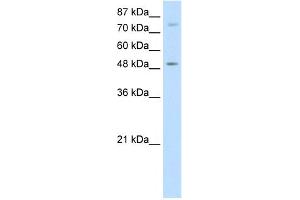 WB Suggested Anti-FOXB1 Antibody Titration:  5. (FOXB1 抗体  (N-Term))