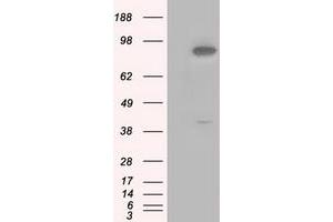Image no. 4 for anti-Betaine--Homocysteine S-Methyltransferase (BHMT) antibody (ABIN1496917) (BHMT 抗体)