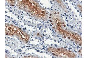 Immunohistochemical staining of paraffin-embedded Human Kidney tissue using anti-SHPK mouse monoclonal antibody. (SHPK 抗体)
