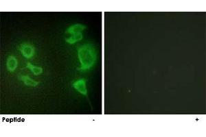 Immunofluorescence analysis of HepG2 cells, using ZAK polyclonal antibody . (ZAK 抗体  (C-Term))