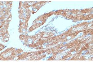 Immunohistochemistry of paraffin-embedded Mouse heart using ACSL3 Polyclonal Antibody at dilution of 1:100 (40x lens). (Acsl3 抗体)