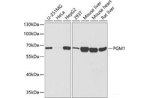 Western blot analysis of extracts of various cell lines using PGM1 Polyclonal Antibody at dilution of 1:1000. (Phosphoglucomutase 1 抗体)