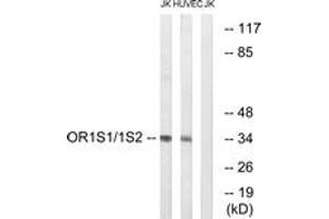Western blot analysis of extracts from Jurkat/HuvEc cells, using OR1S1/1S2 Antibody. (OR1S1/1S2 抗体  (AA 241-290))