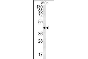 CCYL1 Antibody (N-term) (ABIN651917 and ABIN2840452) western blot analysis in WiDr cell line lysates (35 μg/lane). (CCNYL1 抗体  (N-Term))