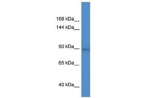 BCL11A antibody used at 0. (BCL11A 抗体  (C-Term))