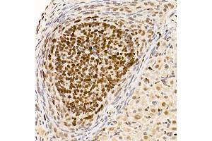 Immunohistochemistry (IHC) image for anti-DNA (Cytosine-5)-Methyltransferase 1 (DNMT1) antibody (ABIN7266808)