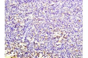 Formalin-fixed and paraffin embedded mouse lymphoma labeled with Anti-MuRF1/Trim63 Polyclonal Antibody, Unconjugated  at 1:200 followed by conjugation to the secondary antibody and DAB staining. (CD7 抗体  (AA 181-240))