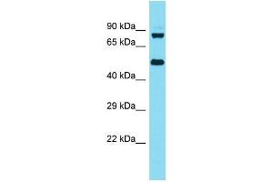 Western Blotting (WB) image for anti-Kelch Repeat and BTB (POZ) Domain Containing 6 (KBTBD6) (N-Term) antibody (ABIN2791601) (KBTBD6 抗体  (N-Term))