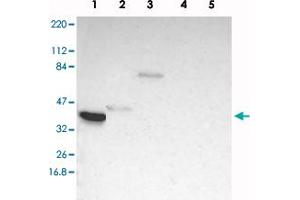 Western blot analysis of Lane 1: RT-4, Lane 2: U-251 MG, Lane 3: Human Plasma, Lane 4: Liver, Lane 5: Tonsil with TFAP4 polyclonal antibody . (TFAP4 抗体)