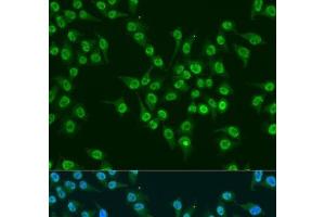 Immunofluorescence analysis of U2OS cells using KLF4 Polyclonal Antibody at dilution of 1:100. (KLF4 抗体)