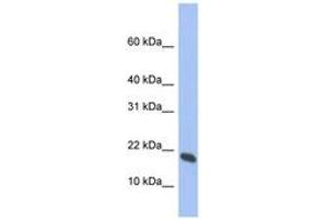 Image no. 1 for anti-Glia Maturation Factor, gamma (GMFG) (AA 35-84) antibody (ABIN6744319) (GMFG 抗体  (AA 35-84))