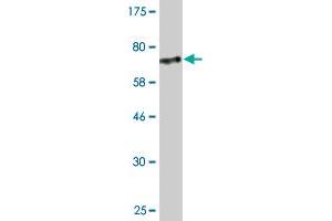Western Blotting (WB) image for anti-SMAD, Mothers Against DPP Homolog 1 (SMAD1) (AA 1-465) antibody (ABIN517612)