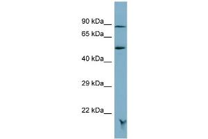Host:  Rabbit  Target Name:  MRAP  Sample Type:  OVCAR-3 Whole cell lysates  Antibody Dilution:  1. (MRAP 抗体  (N-Term))