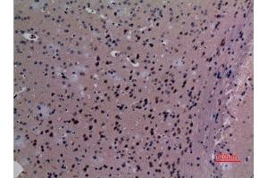 Immunohistochemistry (IHC) analysis of paraffin-embedded Mouse Brain, antibody was diluted at 1:100. (SND1 抗体  (Internal Region))