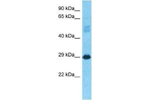 Host:  Rabbit  Target Name:  CJ076  Sample Type:  Fetal Liver lysates  Antibody Dilution:  1. (C10orf76 抗体  (C-Term))