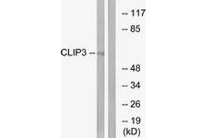 Western Blotting (WB) image for anti-CAP-GLY Domain Containing Linker Protein 3 (CLIP3) (AA 361-410) antibody (ABIN2890180) (CLIP3 抗体  (AA 361-410))