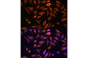 Immunofluorescence analysis of HeLa cells using FBP1 Rabbit mAb (ABIN7267269) at dilution of 1:100 (40x lens). (FBP1 抗体)