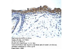 Rabbit Anti-SUV420H1 Antibody  Paraffin Embedded Tissue: Human Skin Cellular Data: Squamous epithelial cells Antibody Concentration: 4. (SUV420H1 抗体  (Middle Region))