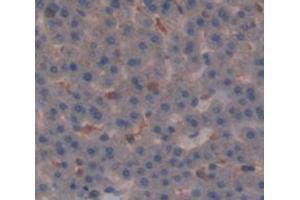 Immunohistochemistry (IHC) image for anti-Nuclear Receptor Subfamily 3, Group C, Member 1 (Glucocorticoid Receptor) (NR3C1) (AA 106-211) antibody (ABIN1174822)