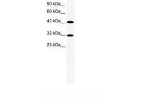 Image no. 1 for anti-General Transcription Factor IIH, Polypeptide 2, 44kDa (GTF2H2) (AA 299-348) antibody (ABIN202422) (GTF2H2 抗体  (AA 299-348))