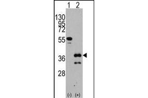 Western blot analysis of ZIC4 (arrow) using rabbit polyclonal ZIC4 Antibody (C-term) (ABIN389183 and ABIN2839346).