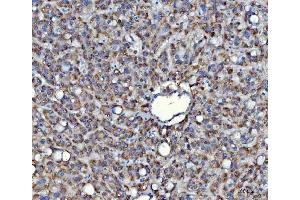 IHC analysis of SAV1 using anti-SAV1 antibody (ABIN7602478).