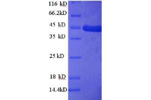 HOMER1 Protein (AA 1-354, full length) (His tag)