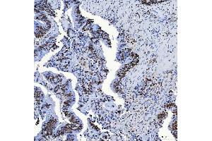IHC analysis of SF3B3 using anti-SF3B3 antibody (ABIN7602378).