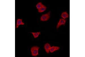 ABIN6265998 and ABIN6273087 staining HepG2 by IF/ICC.