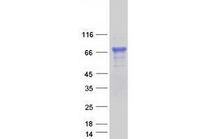Western Blotting (WB) image for Steroid Sulfatase (Microsomal), Isozyme S (STS) protein (Myc-DYKDDDDK Tag) (ABIN2732851)