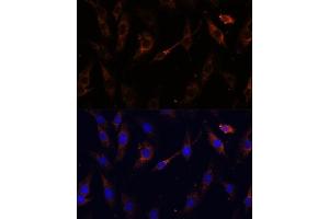 Immunofluorescence analysis of C6 cells using VPS25 Polyclonal Antibody (ABIN6128913, ABIN6150122, ABIN6150123 and ABIN6217011) at dilution of 1:100 (40x lens). (VPS25 抗体  (AA 1-176))