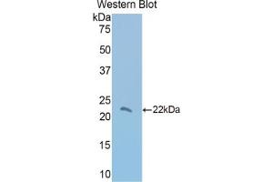 Western blot analysis of the recombinant protein. (Thrombospondin 1 抗体  (AA 957-1129))