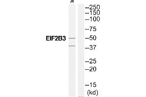 Western blot analysis of extracts from Jurkat cells, using EIF2B3 antibody.