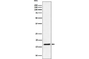 Western blot analysis of Ube2L3 / UBCH7 expression in Jurkat cell lysate.