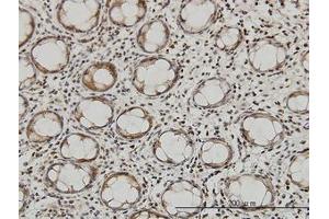 Image no. 4 for anti-Glutaminyl-tRNA Synthetase (QARS) (AA 677-776) antibody (ABIN598566) (QARS 抗体  (AA 677-776))