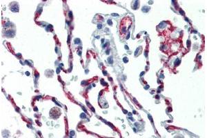 Human Lung (formalin-fixed, paraffin-embedded) stained with CD34 antibody ABIN461990 at 1:50 followed by biotinylated anti-mouse IgG secondary antibody ABIN481714, alkaline phosphatase-streptavidin and chromogen. (CD34 抗体  (FITC))
