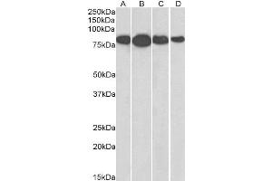 ABIN2564861 (0. (Radixin 抗体  (Internal Region))