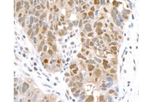 Immunohistochemistry (IHC) image for anti-Glyceraldehyde-3-Phosphate Dehydrogenase (GAPDH) (AA 225-275) antibody (ABIN7449428) (Recombinant GAPDH 抗体  (AA 225-275))