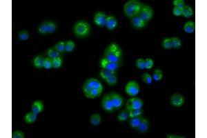 Image no. 5 for anti-Acetyl-CoA Acetyltransferase 2 (ACAT2) antibody (ABIN1496401) (ACAT2 抗体)