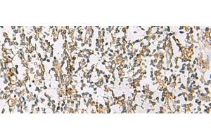 Immunohistochemistry of paraffin-embedded Human tonsil tissue using ZPBP2 Polyclonal Antibody at dilution of 1:80(x200) (ZPBP2 抗体)