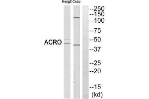 Western Blotting (WB) image for anti-Acrosin (ACR) (Cleaved-Ile43), (N-Term) antibody (ABIN1853476) (Acrosin 抗体  (Cleaved-Ile43, N-Term))