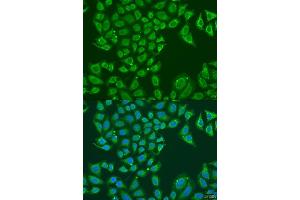 Immunofluorescence analysis of U2OS cells using B1 antibody (ABIN7265534) at dilution of 1:100. (ALDH1B1 抗体  (AA 278-517))