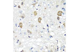 Immunohistochemistry of paraffin-embedded rat brain using RBP2 antibody (ABIN5974059) at dilution of 1/100 (40x lens). (RBP2 抗体)